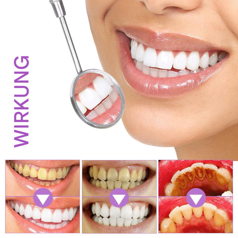 teeth whitening strips
