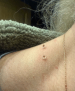 Hautanhängsel Entferner Set Frauen